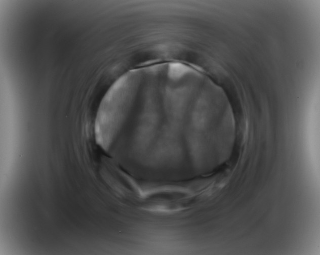 X0000083980137200703091832