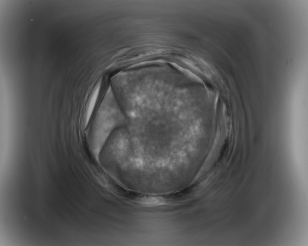 X0000083980409200703091828