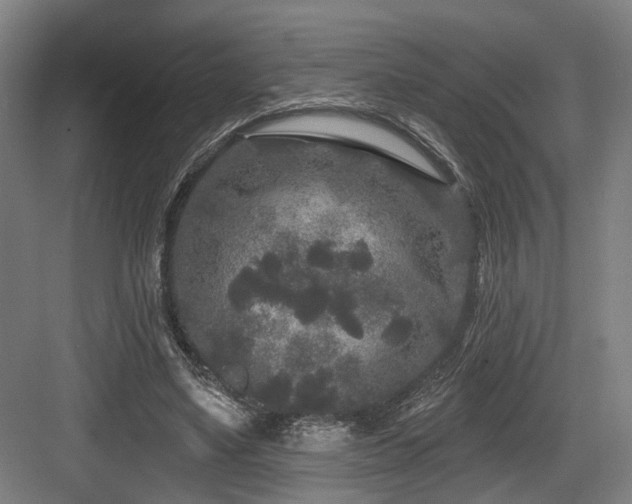 X0000083990491200702161136