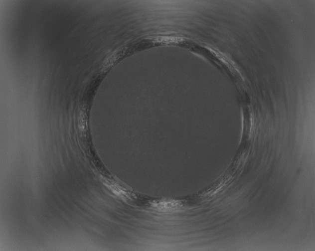 X0000083990517200702232114