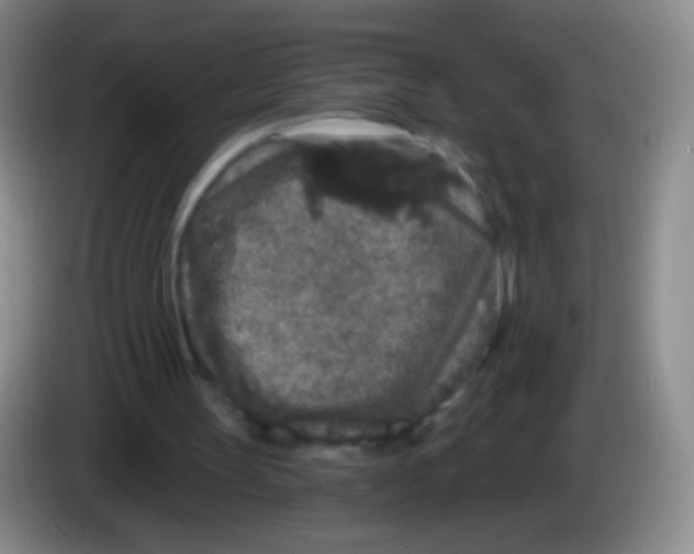 X0000083990147200703091852