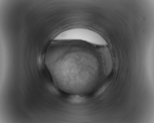 X0000083990239200703091852