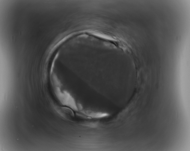 X0000083990247200703091851