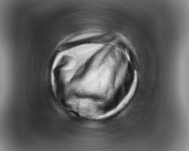 X0000083990249200703091851