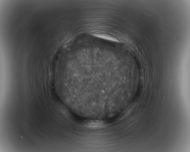 X0000083990369200703091850