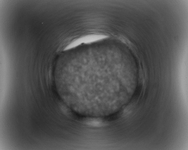 X0000083990377200703091850