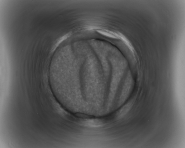 X0000083990385200703091850