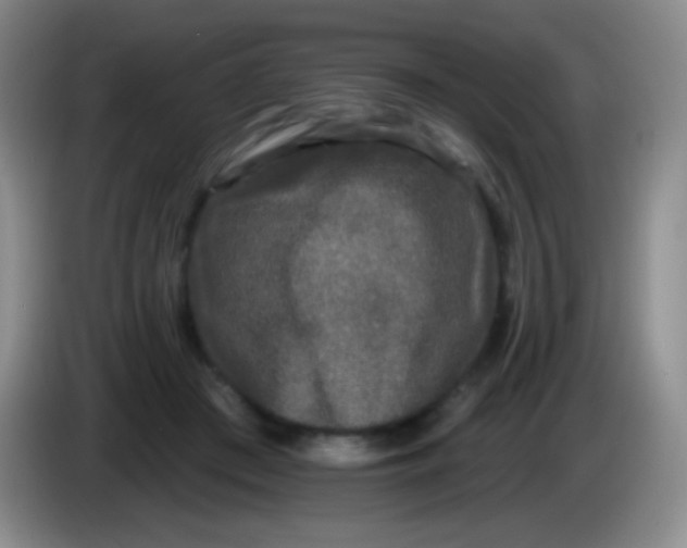 X0000083990409200703091849