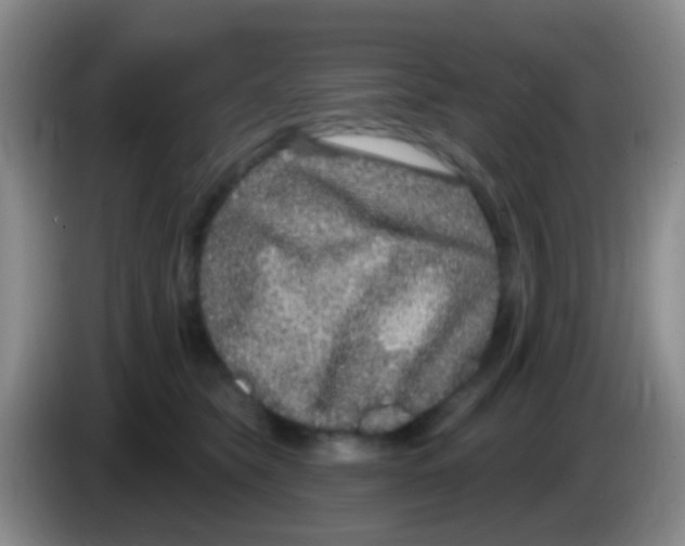 X0000083990565200703091847