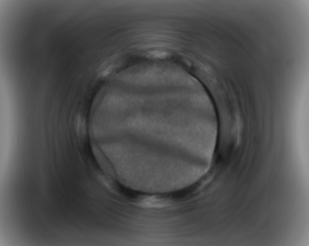 X0000083990568200703091848