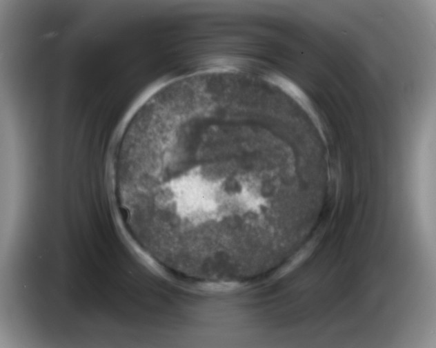 X0000083990859200703091844