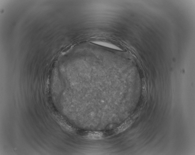 X0000083990369200703161629