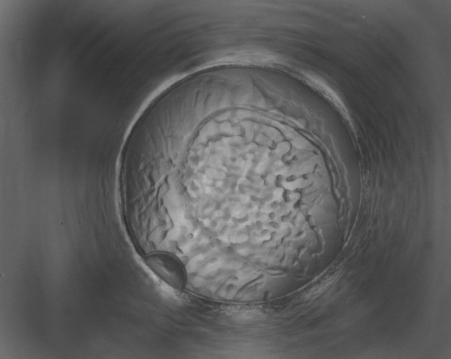 X0000084011103200702232157