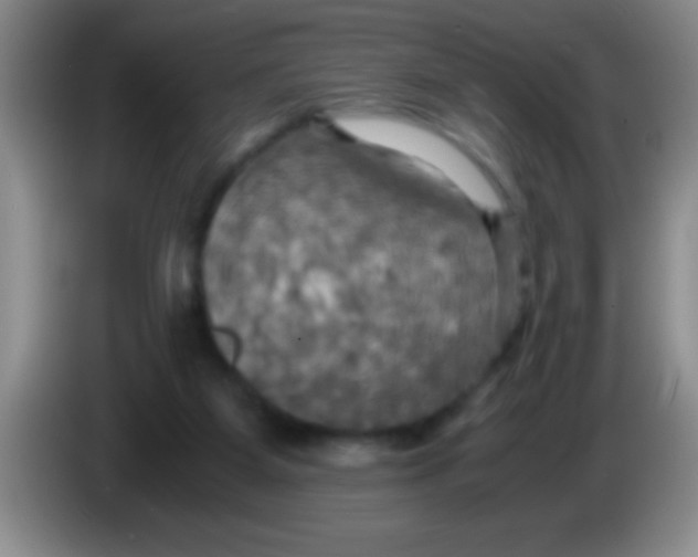 X0000084010115200703091935