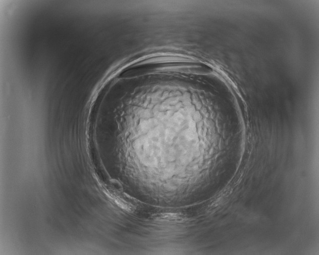 X0000084020151200702161237
