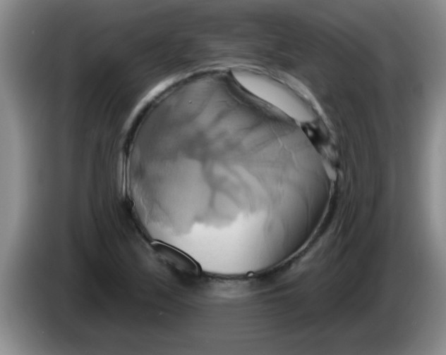 X0000084021171200703091942