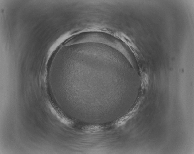 X0000084520152200702231143