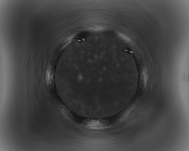 X0000084520177200703021405