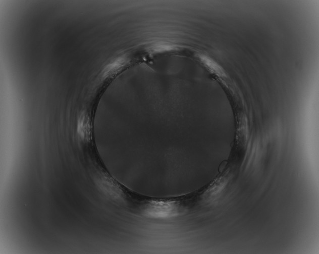 X0000084520469200703021400