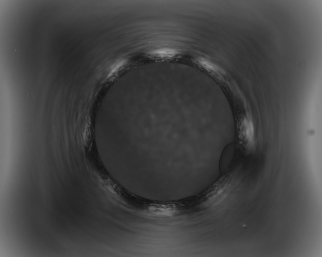 X0000084520559200703021358