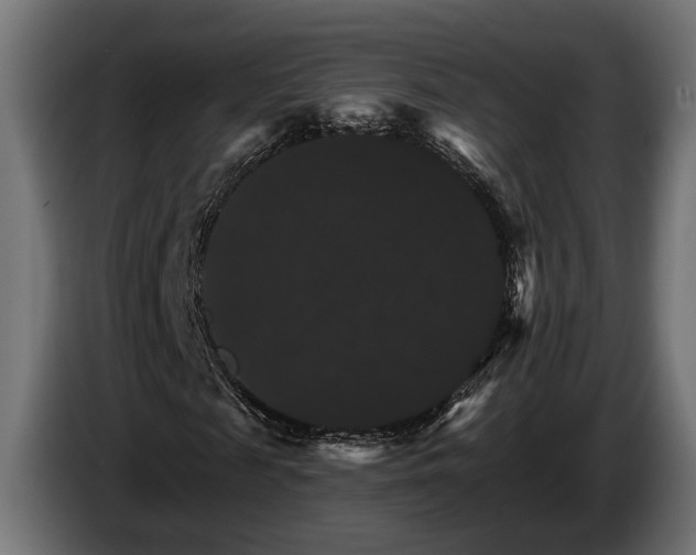 X0000084520817200703021353