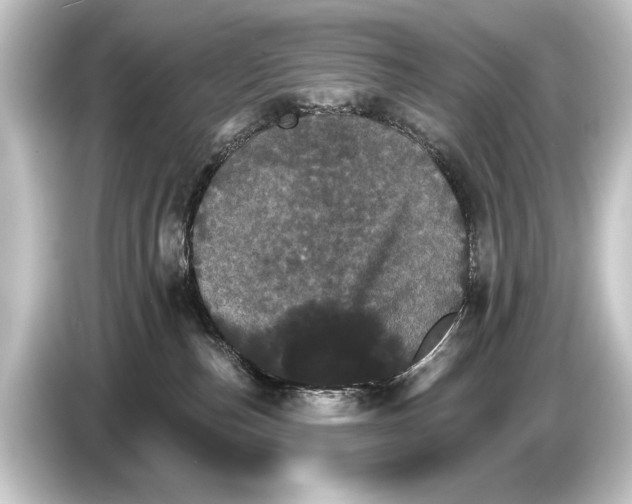 X0000084520187200703161555