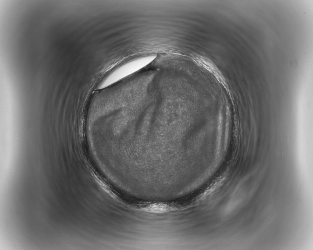 X0000084520441200703161551