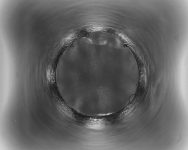 X0000084520469200703161551