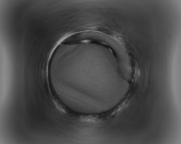 X0000084520148200703231638