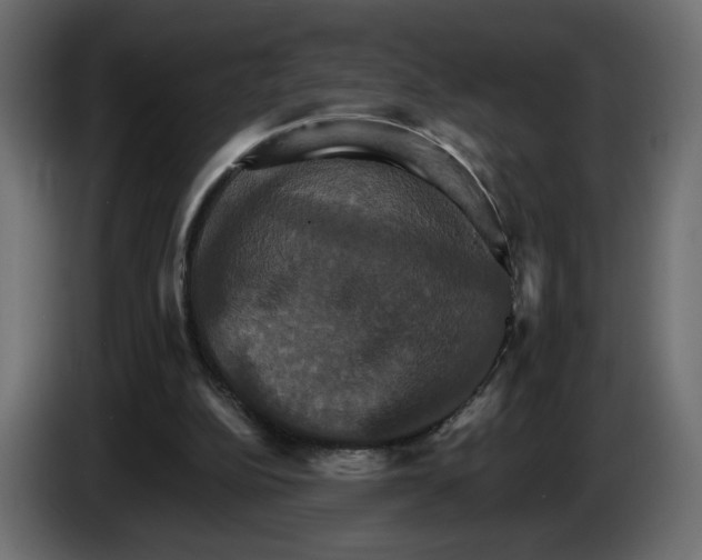 X0000084520152200703231638