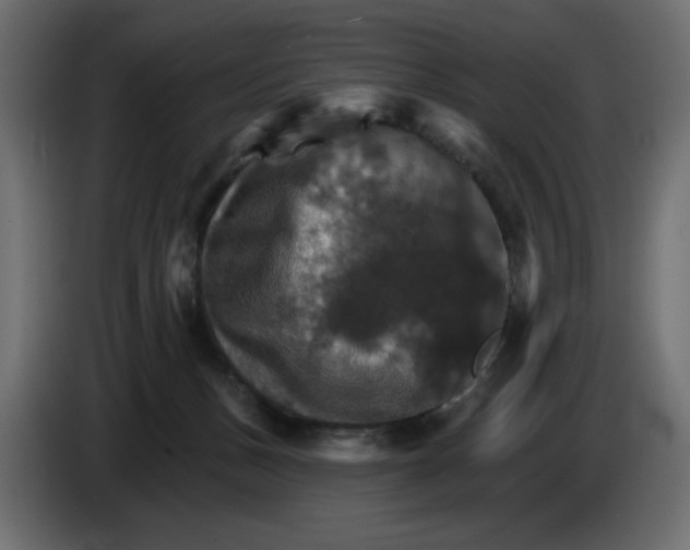 X0000084520175200703231638