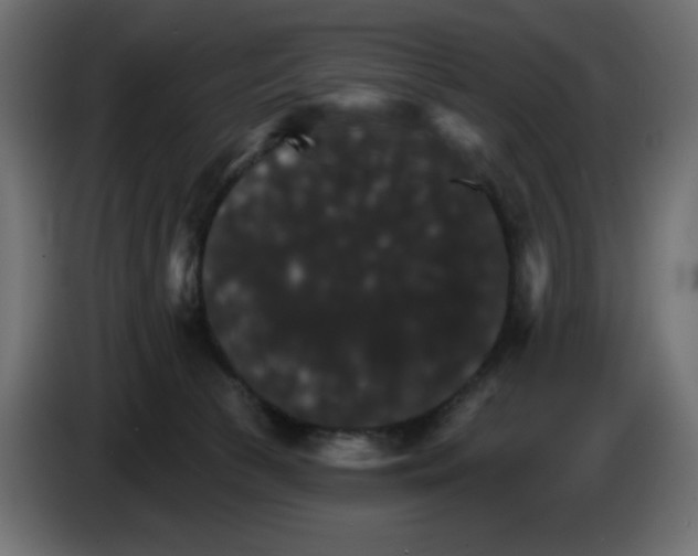 X0000084520177200703231638