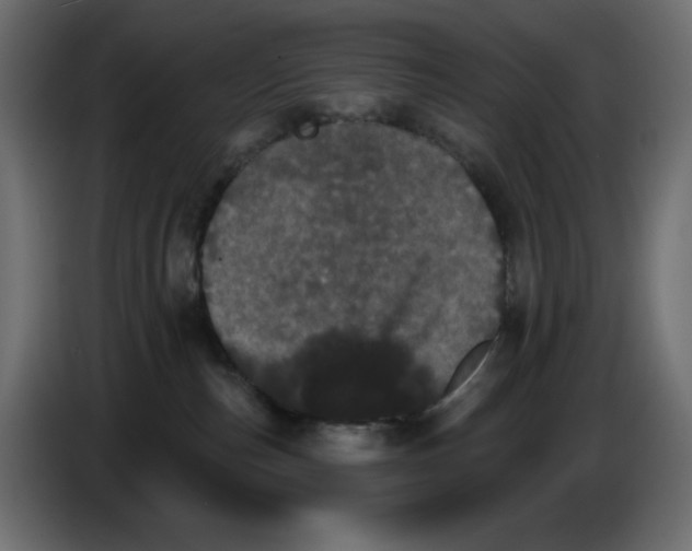 X0000084520187200703231638