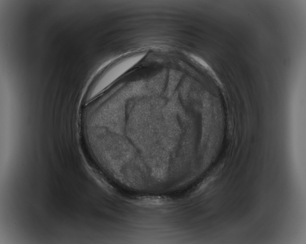 X0000084520439200703231634