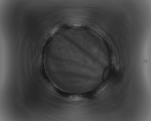 X0000084520559200703231633