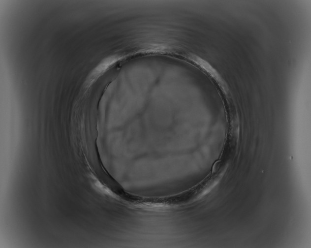 X0000084520577200703231632