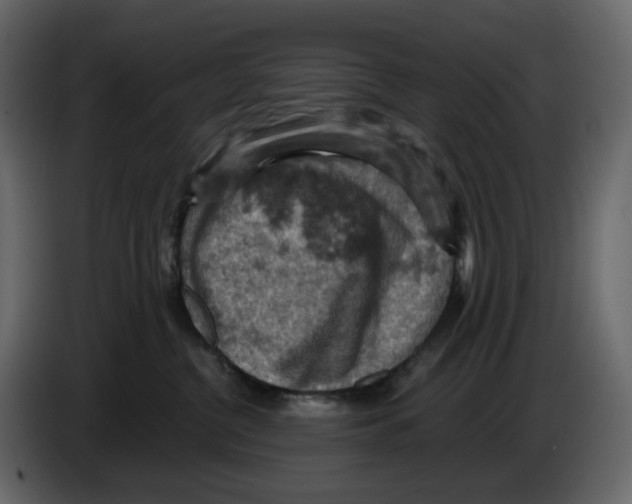 X0000084530380200703231658
