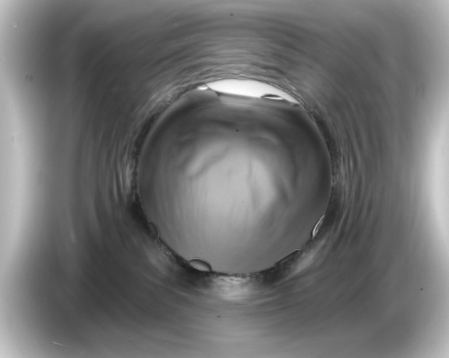 X0000084540139200703161635