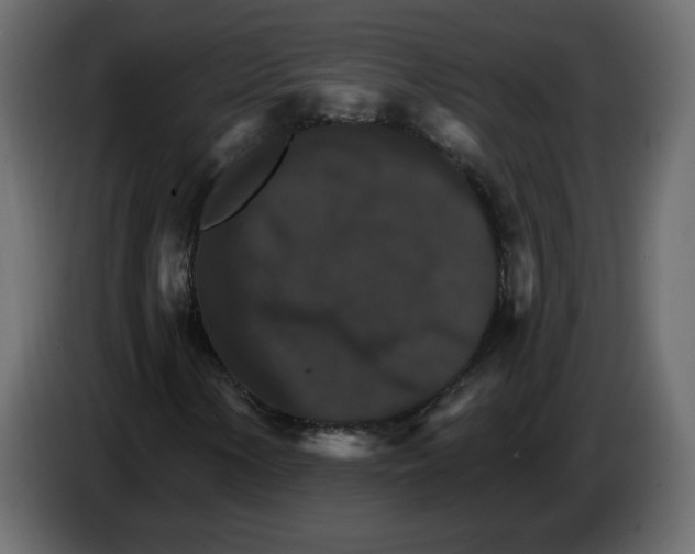 X0000084541154200703231708