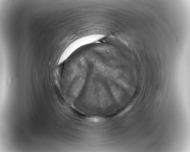 X0000084560432200703161707