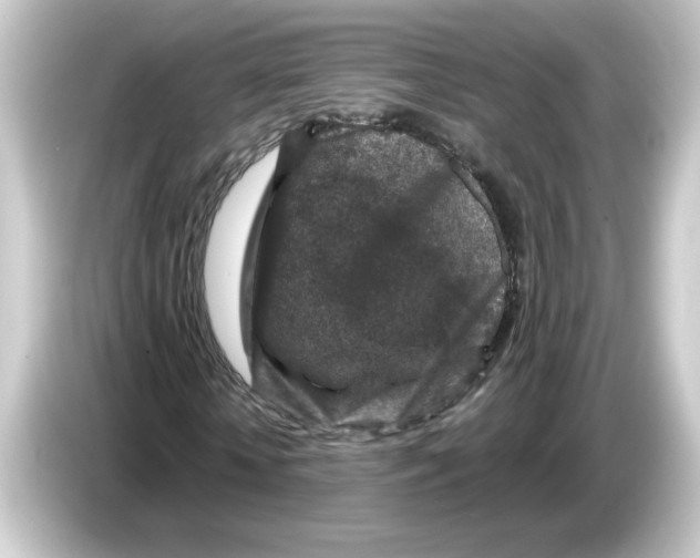 X0000084560818200703161702