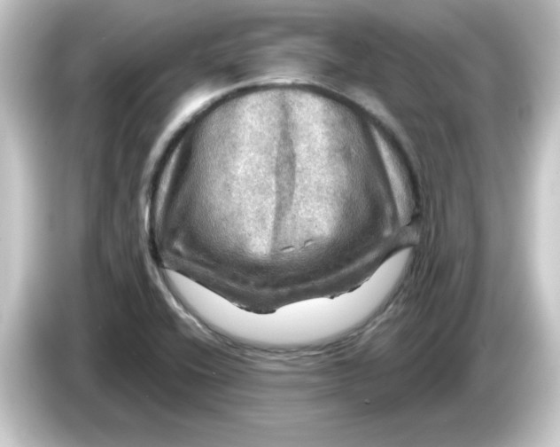 X0000084561416200703161656