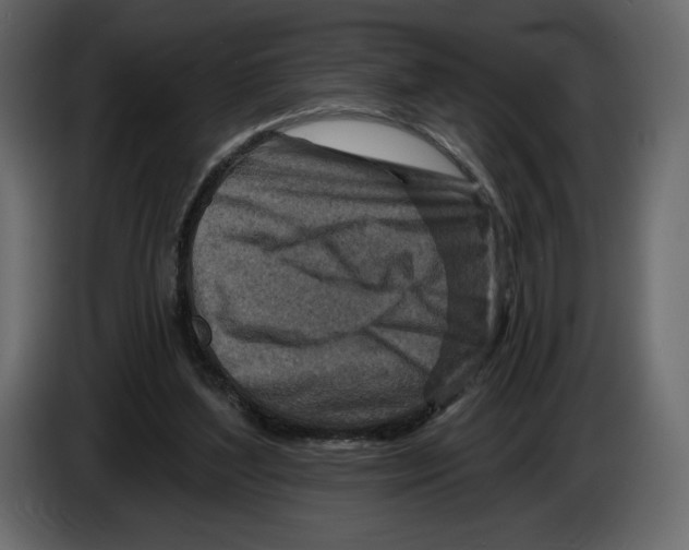 X0000084560204200703231806