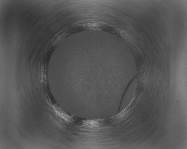 X0000084570140200702231309