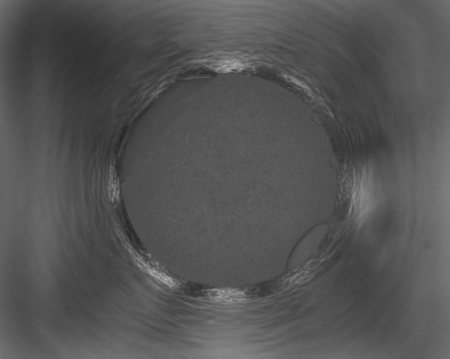X0000084570719200702231259