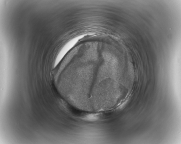 X0000084570178200703161729
