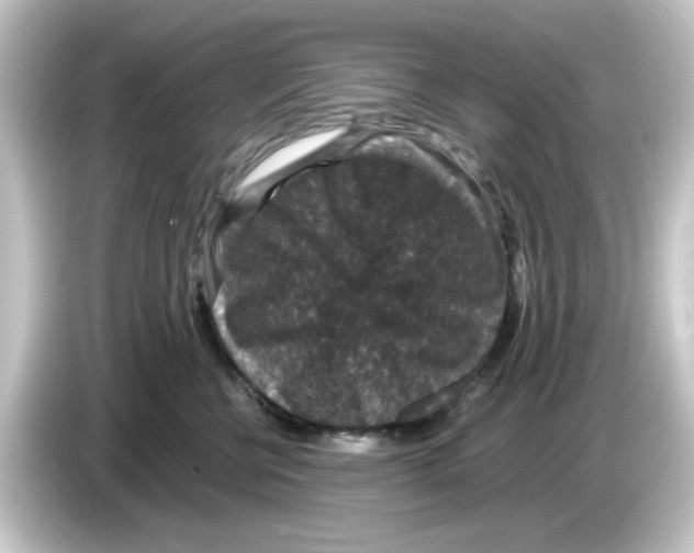 X0000084570570200703161725