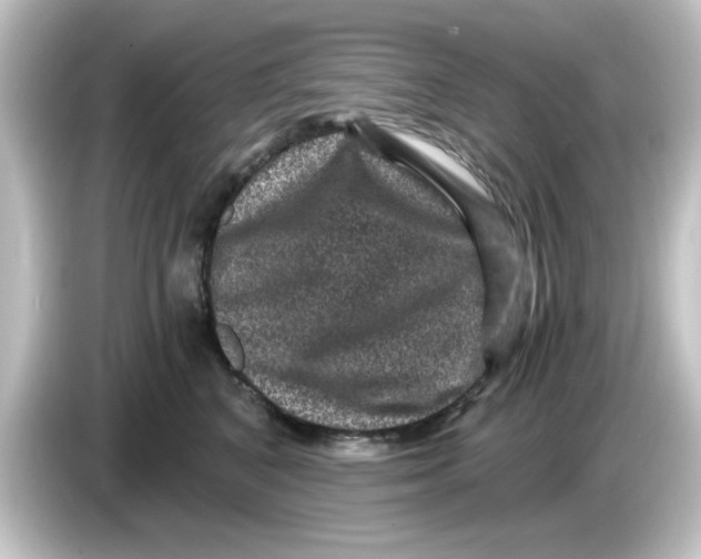 X0000084570616200703161724