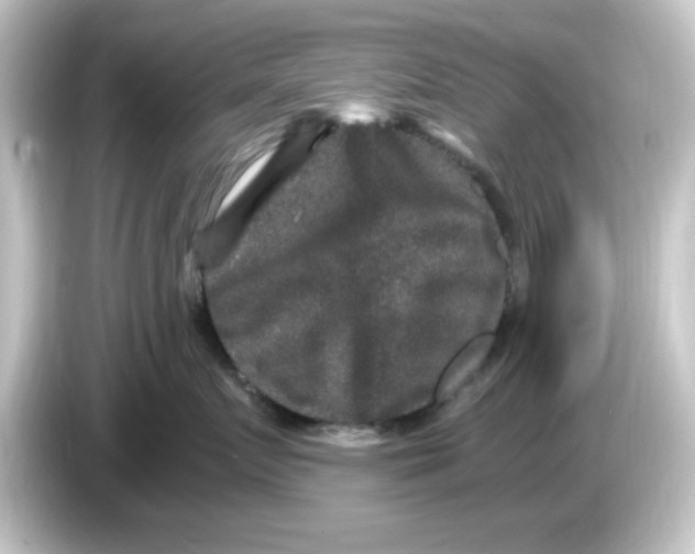 X0000084570719200703161722