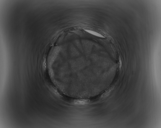 X0000084570479200703231825